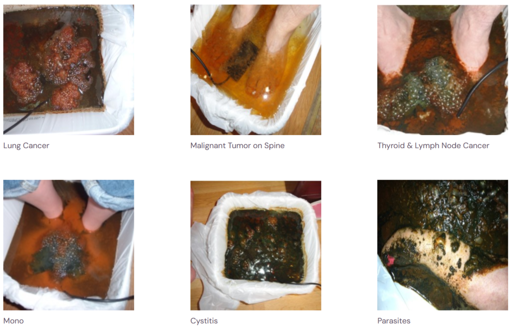 Foot Bath collage