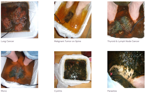 natural detox foot bath in Lakeway, TX